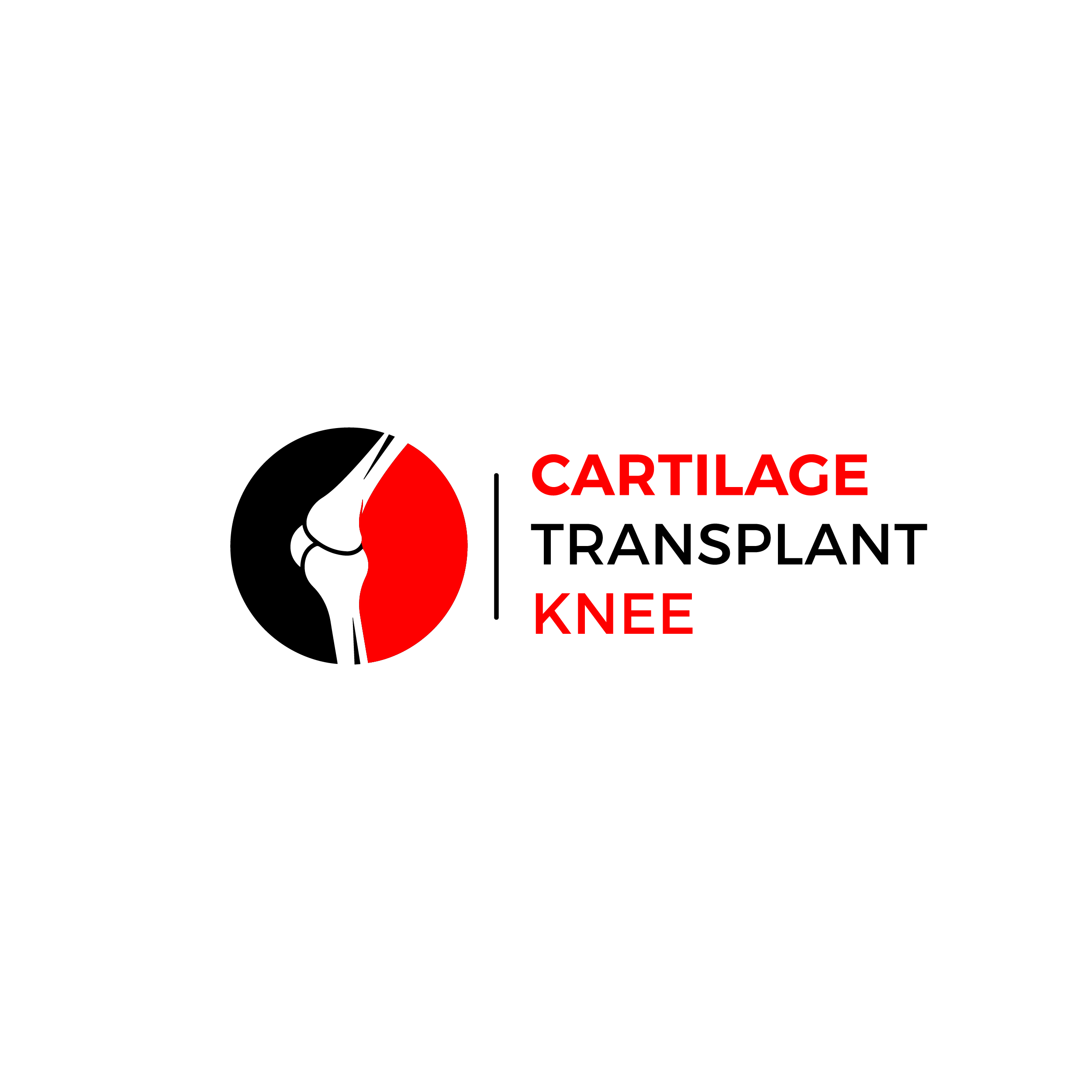 Revive, Restore, Rejoice: Cartilage Transplant Knee for Enhanced Mobility